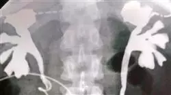 ##IMAGE##
