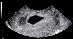 curso imagen clínica de la patología aguda del aparato reproductor en urgencias y cuidados críticos