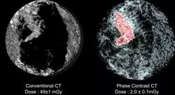 curso online imagen clínica de la patología aguda del aparato reproductor en urgencias y cuidados críticos
