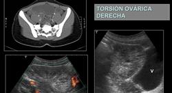 formacion imagen clínica de la patología aguda del aparato reproductor en urgencias y cuidados críticos