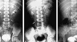 curso imagen clínica de la patología aguda del aparato urinario en urgencias y cuidados críticos