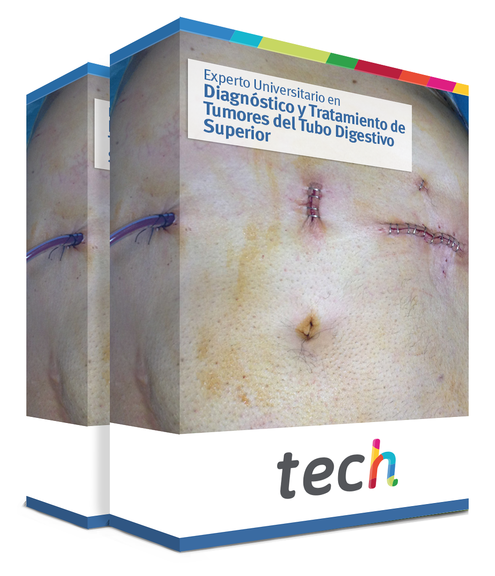 especializacion diagnostico tratamiento tumores tubo digestivo superior caja