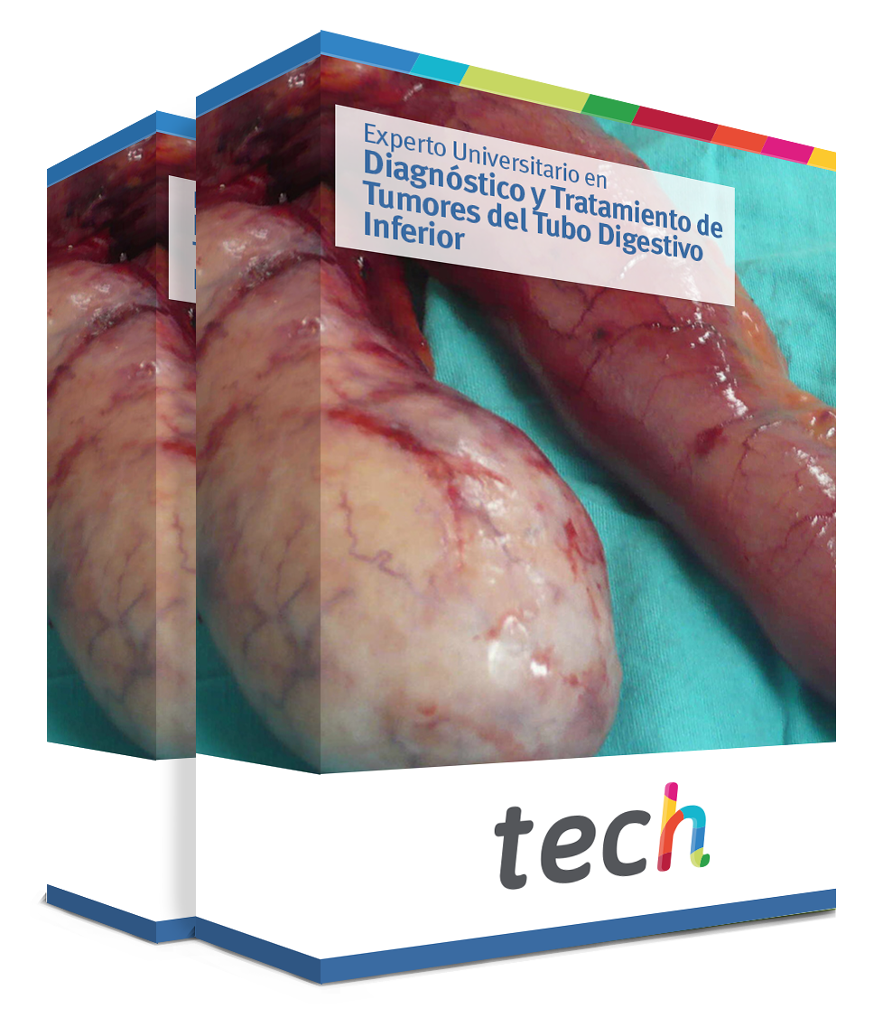 especializacion diagnostico tratamiento tumores tubo digestivo inferior caja