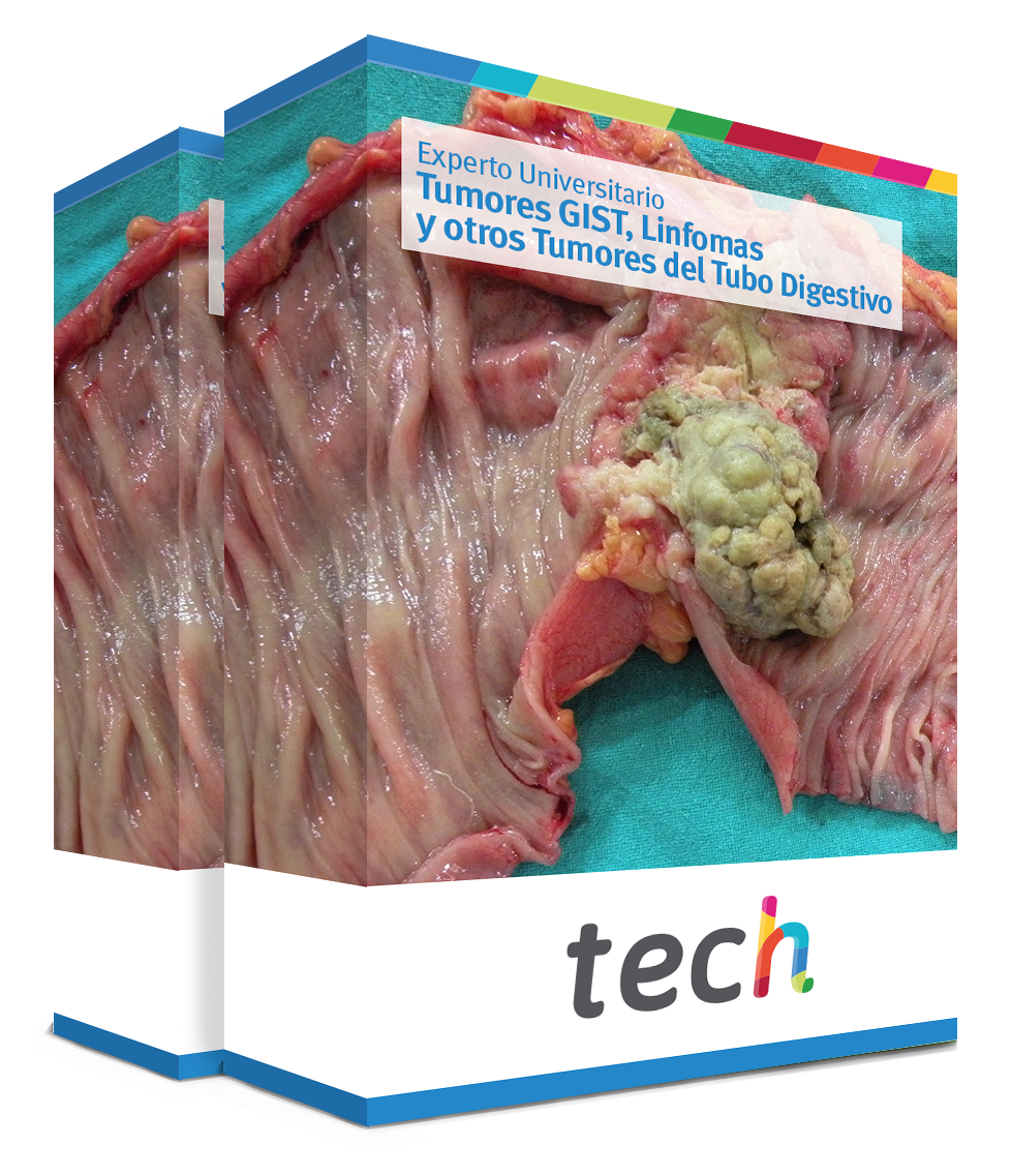 especializacion tumores gist linfomas tumores tubo digestivo caja
