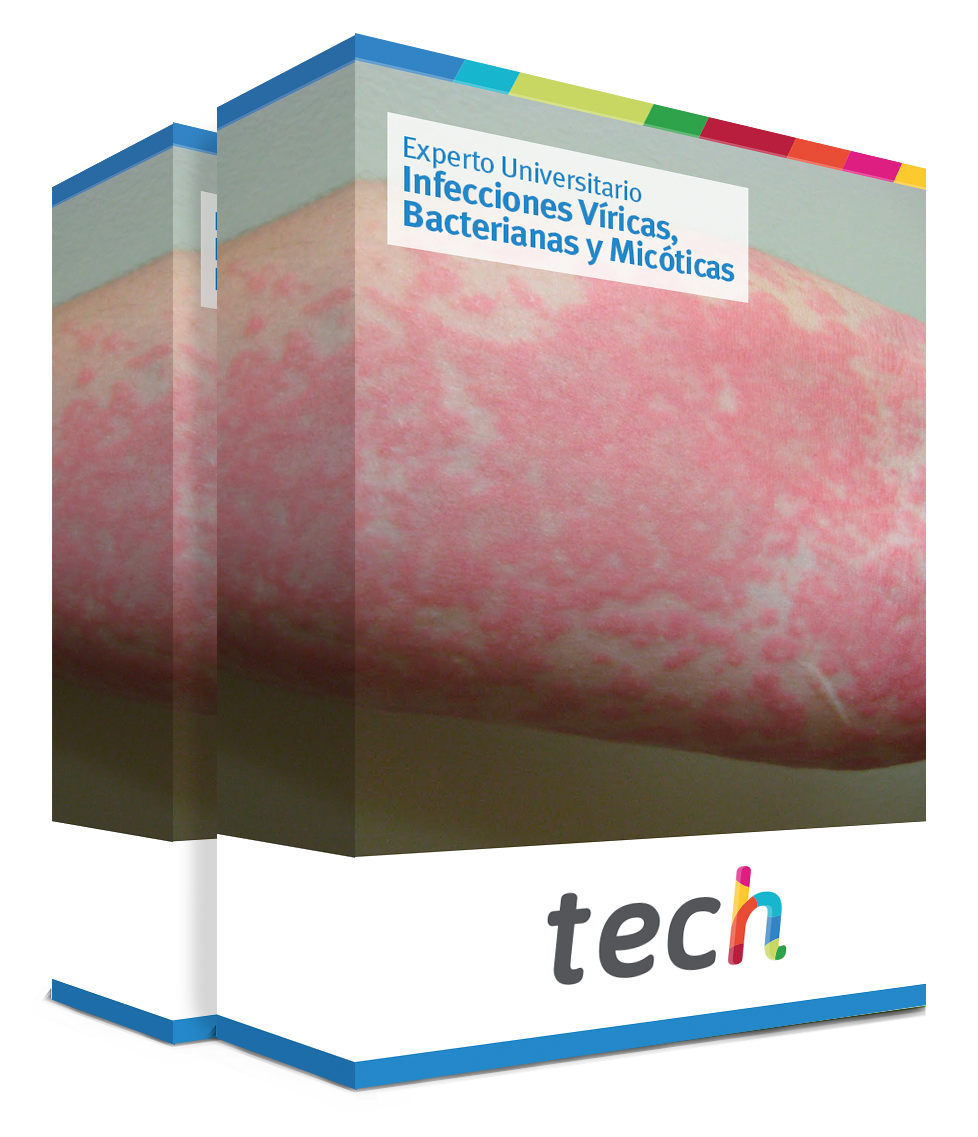 especializacion infecciones viricas bacterianas micoticas caja