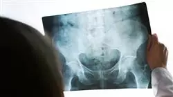 ##IMAGE##