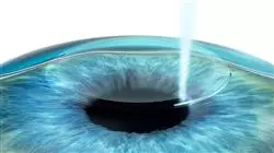 ##IMAGE##