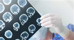 cursos manejo diagnóstico de los tumores cerebrales