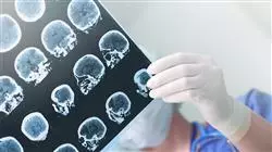 especializacion online manejo diagnostico tumores cerebrales