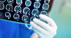 estudiar manejo de los tumores cerebrales en edad pediátrica
