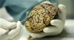 especialización manejo de los tumores cerebrales en edad pediátrica