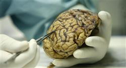 curso manejo de las metástasis cerebrales y leptomeníngeas