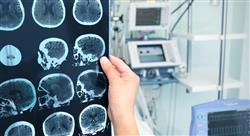 curso tumores cerebrales a la edad pediátrica