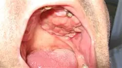 ##IMAGE##