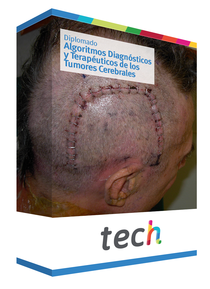 diplomado algoritmos diagnosticos terapeuticos tumores cerebrales caja