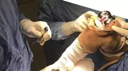 ##IMAGE##