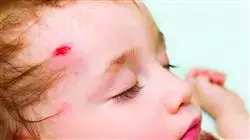 ##IMAGE##