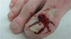 ##IMAGE##