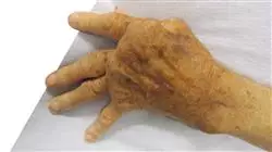 ##IMAGE##