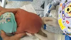 ##IMAGE##