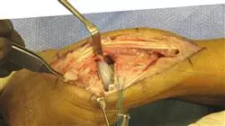 ##IMAGE##