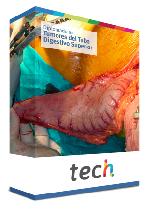 diplomado tumores tubo digestivo superior caja