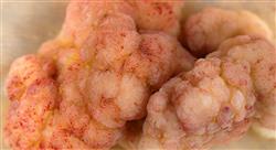 formacion tumores pancreáticos biliares y hepáticos