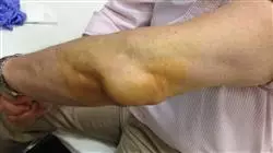 ##IMAGE##
