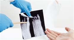 curso urgencias traumatológicas de pie y tobillo