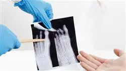 ##IMAGE##