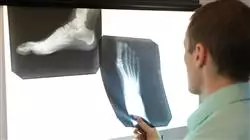 ##IMAGE##