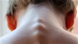##IMAGE##