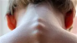 ##IMAGE##