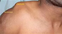 ##IMAGE##