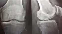 ##IMAGE##