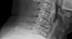 especializacion urgencias traumatológicas en columna vertebral