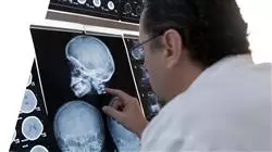 ##IMAGE##