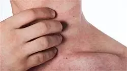 ##IMAGE##