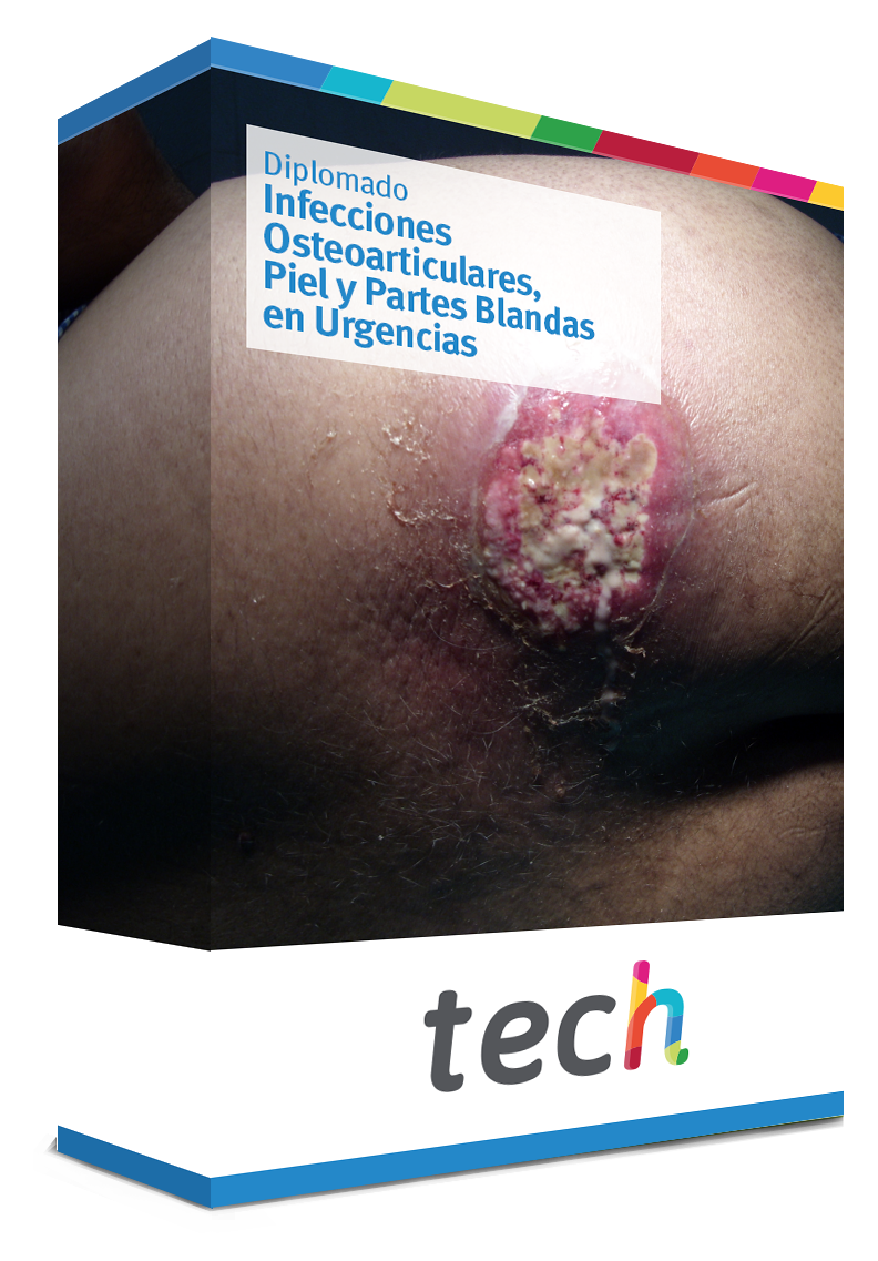 diplomado infecciones osteoarticulares piel partes blandas urgencias caja