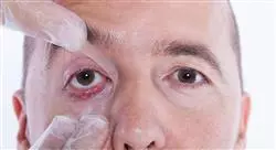 curso infecciones oftalmológicas otorrinolaringológicas y de la cavidad oral en urgencias