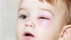##IMAGE##