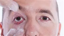 ##IMAGE##