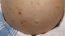 ##IMAGE##