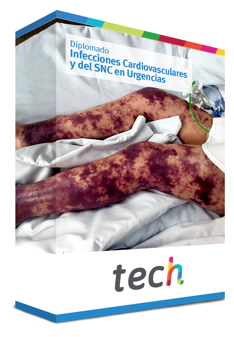 diplomado infecciones cardiovasculares snc urgencias caja