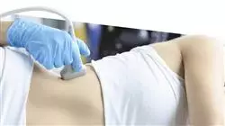 ##IMAGE##