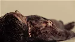 ##IMAGE##