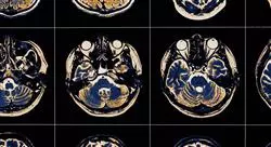 maestria medicina rehabilitadora en el abordaje del daño cerebral adquirido