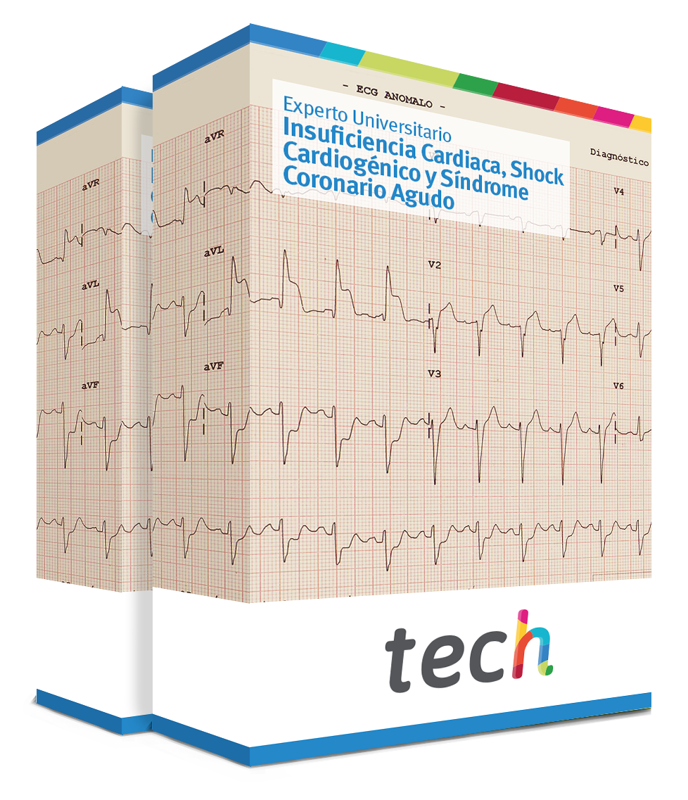 especializacion insuficiencia cardiaca shock cardiogenico sindrome coronario agudo caja