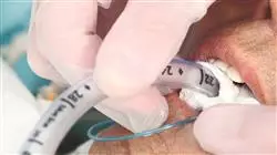 ##IMAGE##