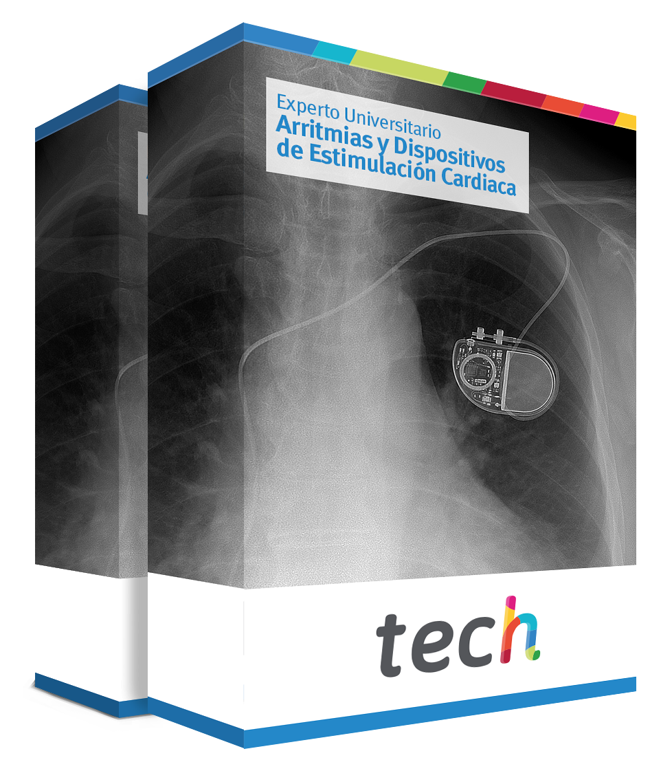 especializacion arritmias dispositivos estimulacion cardiaca caja
